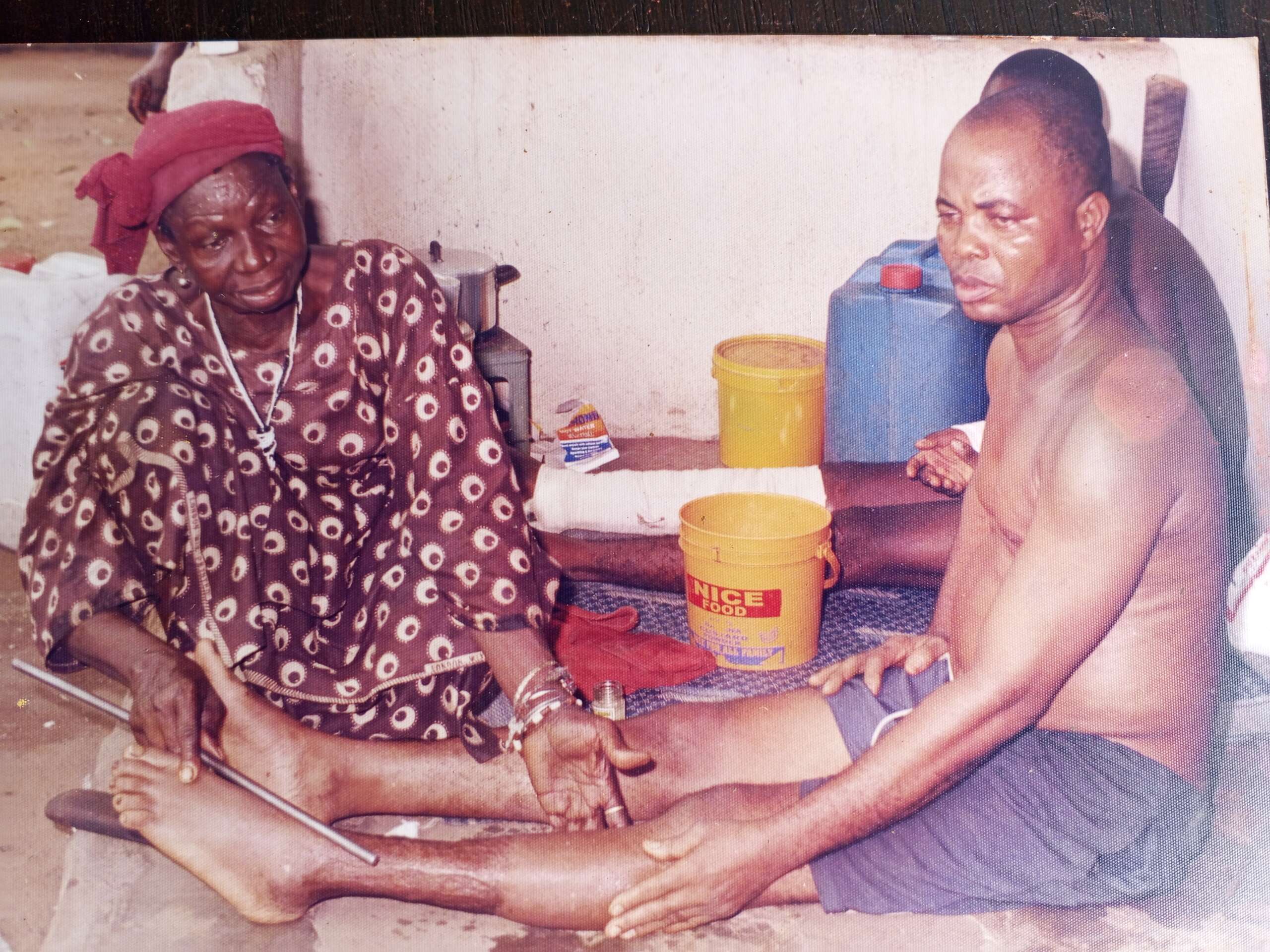 Awusigwe ogwo, a dibia okpukpu with a patient who is fully healed with a well aligned leg that has gone back to the original state in Amorka, Anambra state. Photo credit : ogwo family archives